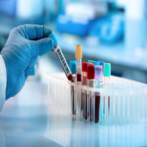 T L C (Total Leukocyte Count Test)